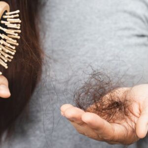 Cara Mengatasi Rambut Rontok Berlebihan dengan Mudah dan Simpel